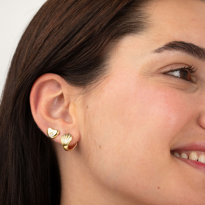 Arete gota irregular