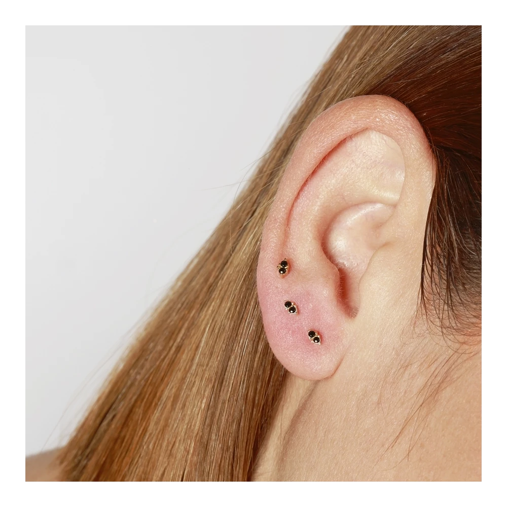 Arete 2 triangulos